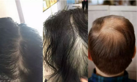 唯拾壹跨境美妝|我缺的不是卷發棒！不是錢！是頭發啊