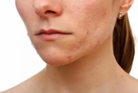 NEWNEW DIY|韓國美容效果那么好，原來是她們在術(shù)后用了這個