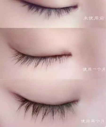 想成為迷人的睫毛精，用iGLORY睫毛增長(zhǎng)液