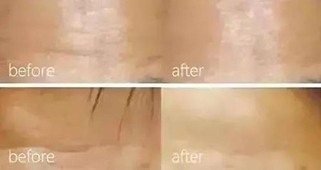 還在靠敷面膜補水？那你的皮膚肯定出問題！