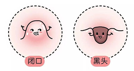 “閉口”這個磨人的小妖精又出來作妖啦！