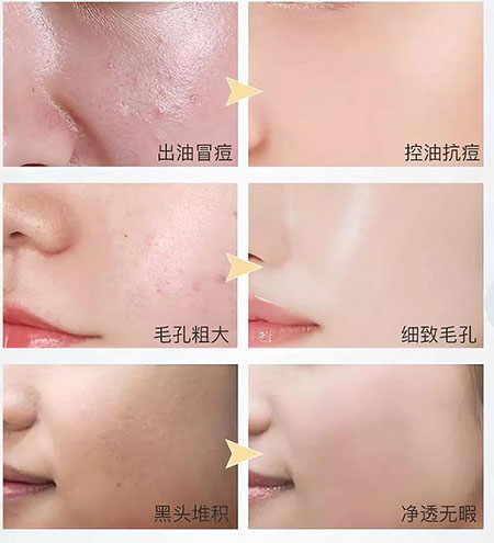 韓詩緹教你正確洗臉，現在！立刻！馬上！改善皮膚問題