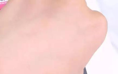 敏感肌不能化妝？良心推薦這款修復(fù)遮瑕霜！