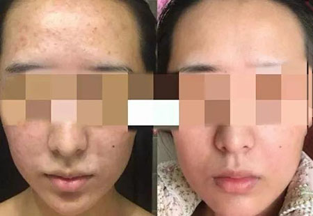 粉絲真實(shí)測(cè)評(píng)！DIY私人定制護(hù)膚品真有那么神奇嗎？