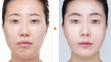 水氧活膚—“氧”出好氣色，打造人見人愛的水嫩美肌~