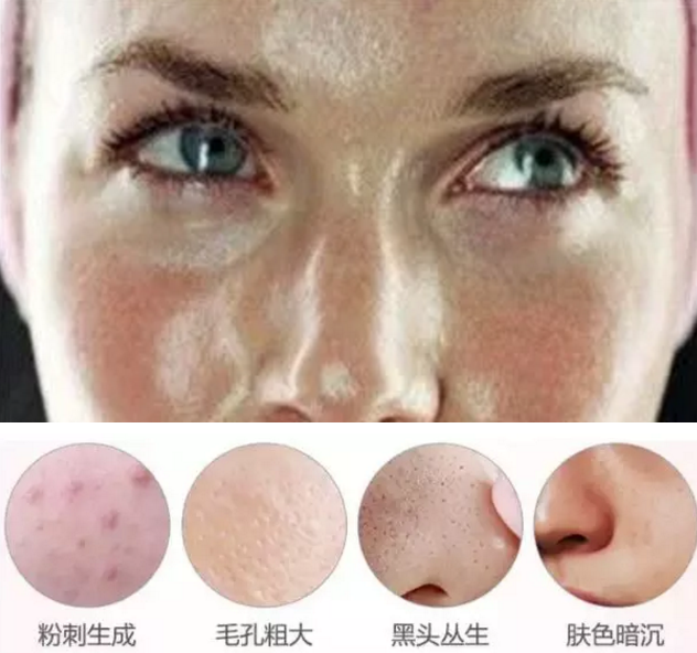 韓詩緹超強清潔組合駕到，輕松get凈透美顏的洗臉藝術~~