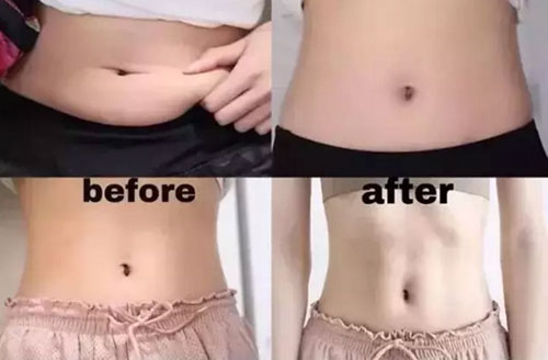 真的瘦|不節(jié)食不運(yùn)動(dòng)，躺著不知不覺就變瘦，這事你干不干?