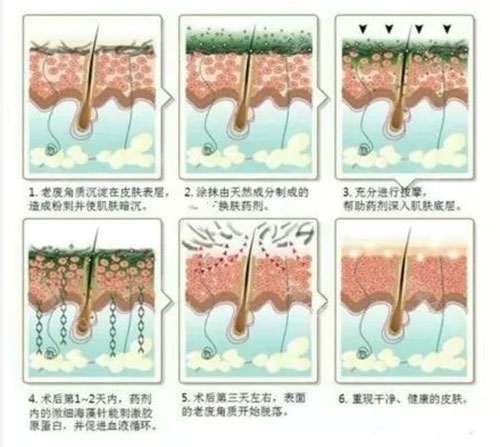 提亮膚色,收毛孔改善皺紋