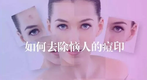 美容界的磨皮針——海藻煥膚，功效可不僅是祛痘這么簡單!