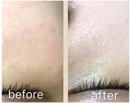 水光嫩膚管理深度補水、鎖水保濕