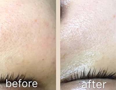 智能光電美膚VC美白+補(bǔ)水組合管理