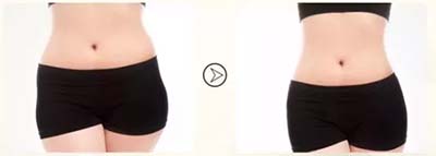 “操作30分鐘，腰圍減少3-6公分”這種健康美容瘦身的方法你知道嗎